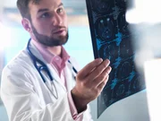 Alterações do Alzheimer podem surgir antes de falhas na memória, diz estudo