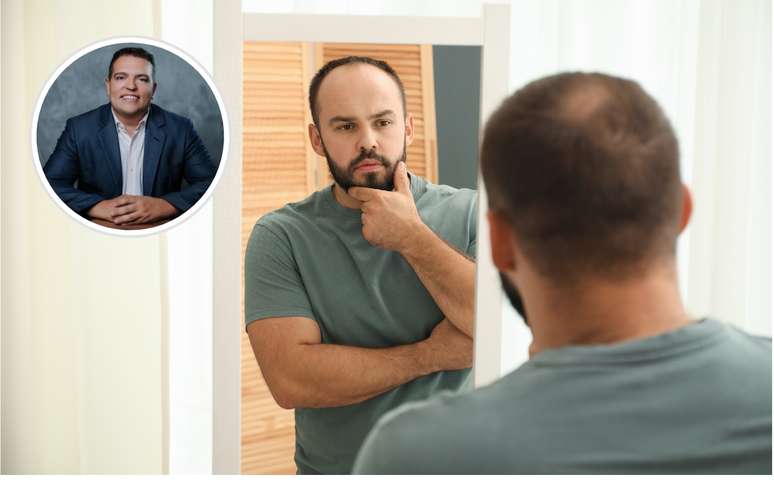 A calvície não começa quando o cabelo cai. Ela começa quando você muda seus hábitos
