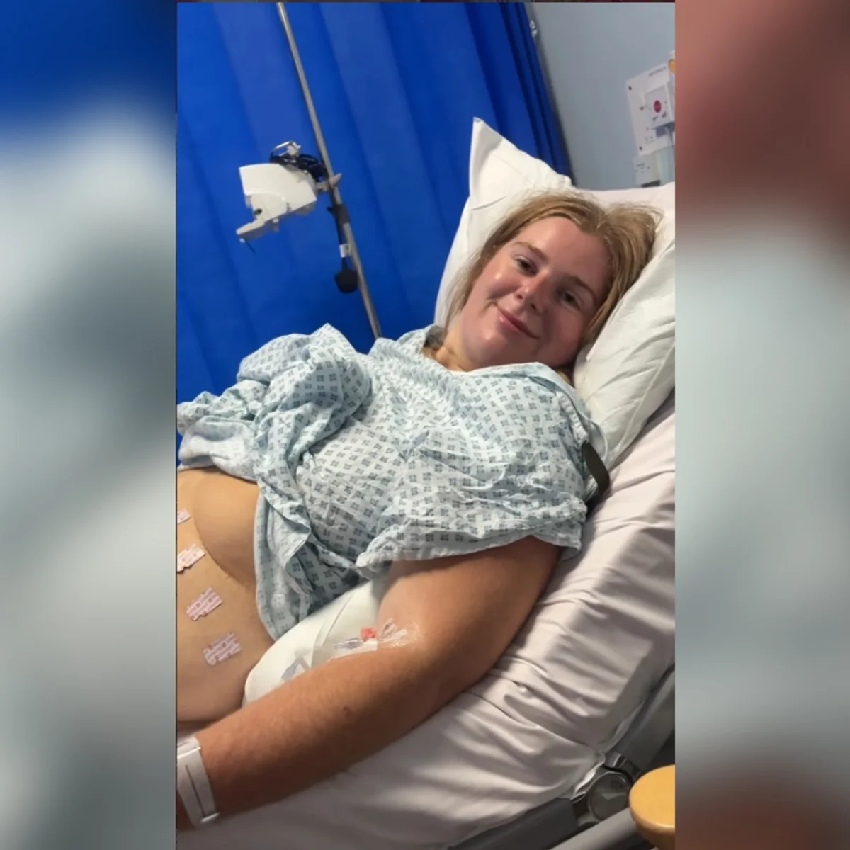 Mulher quase morre por sepse após espremer pelo encravado na virilha