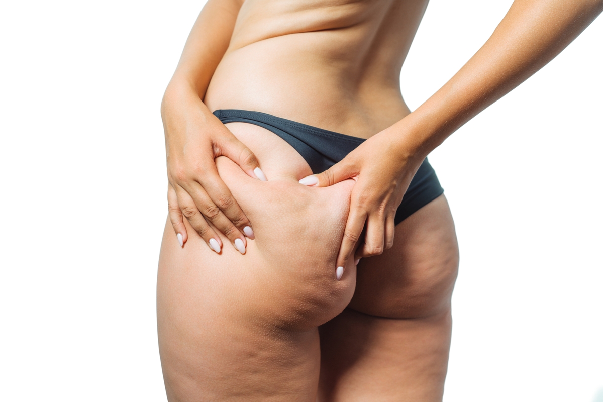 Dry brushing: prática de escovar celulites não tem comprovação científica