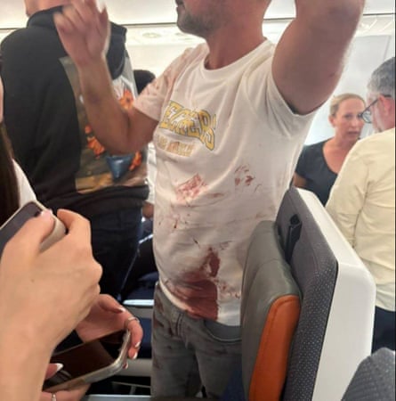 One of the people injured in the incident.